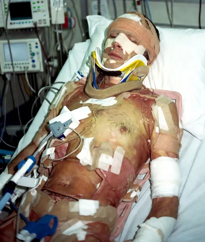 Roberto no hospital